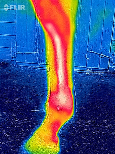 Hands v's Thermography